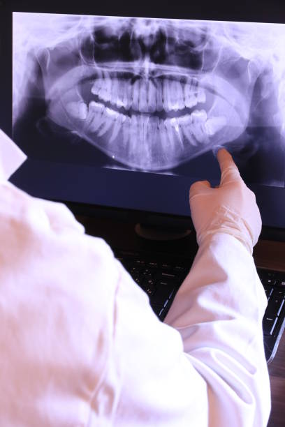 Best Emergency Dentist for Lost Fillings or Crowns in Citrus Heights, CA